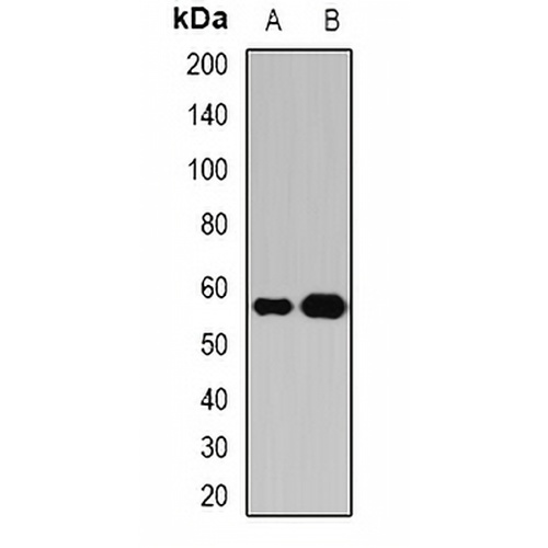 Atase Rabbit Polyclonal Antibody