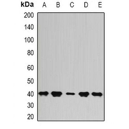PSAT1 Rabbit Polyclonal Antibody