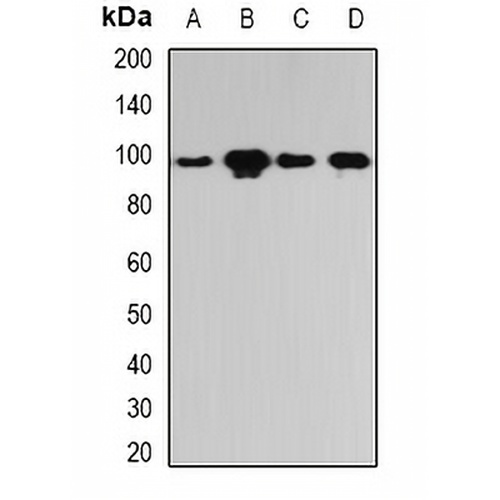 PYGL Rabbit Polyclonal Antibody