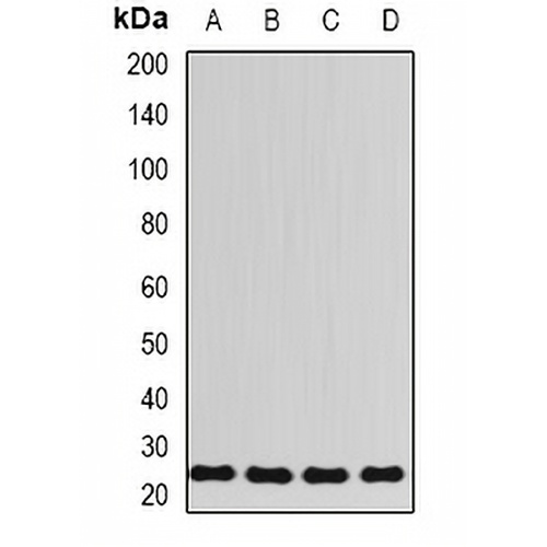 RPL13 Rabbit Polyclonal Antibody