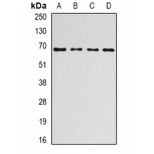 Ribophorin-1 Rabbit Polyclonal Antibody