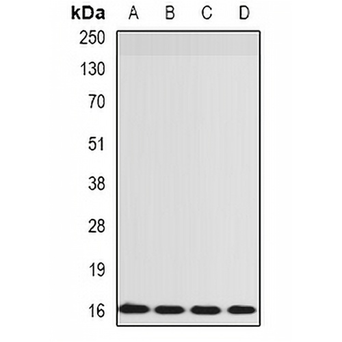 RPS14 Rabbit Polyclonal Antibody