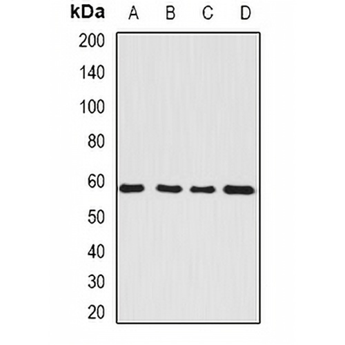 SerRS Rabbit Polyclonal Antibody