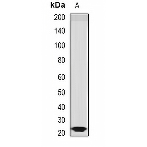 Sorcin Rabbit Polyclonal Antibody