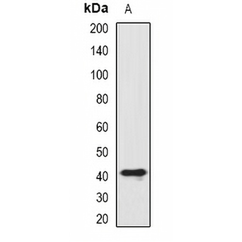 SIAT8D Rabbit Polyclonal Antibody