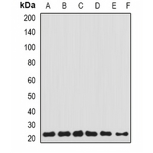 Transgelin-2 Rabbit Polyclonal Antibody