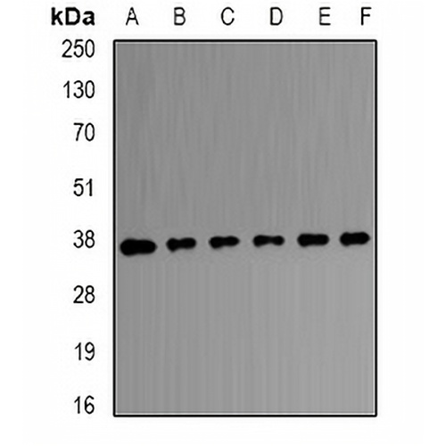 Transaldolase Rabbit Polyclonal Antibody