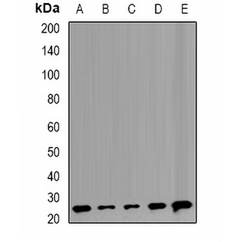 TMP21 Rabbit Polyclonal Antibody