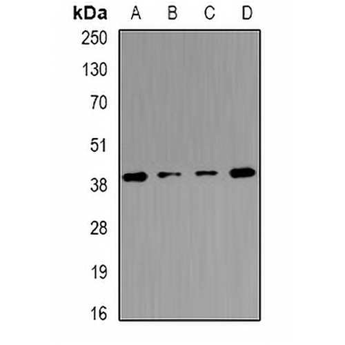 Tropomodulin-4 Rabbit Polyclonal Antibody