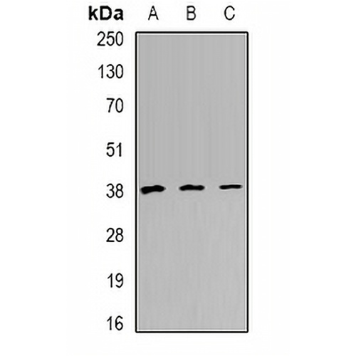 TREX1 Rabbit Polyclonal Antibody