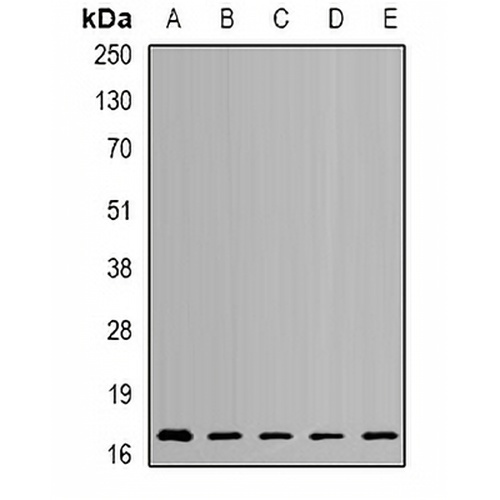 NUDT2 Rabbit Polyclonal Antibody