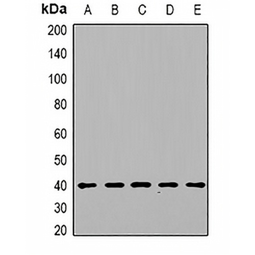 DGUOK Rabbit Polyclonal Antibody
