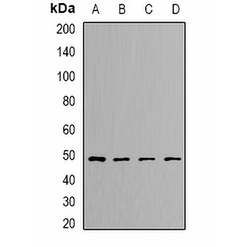 DLST Rabbit Polyclonal Antibody