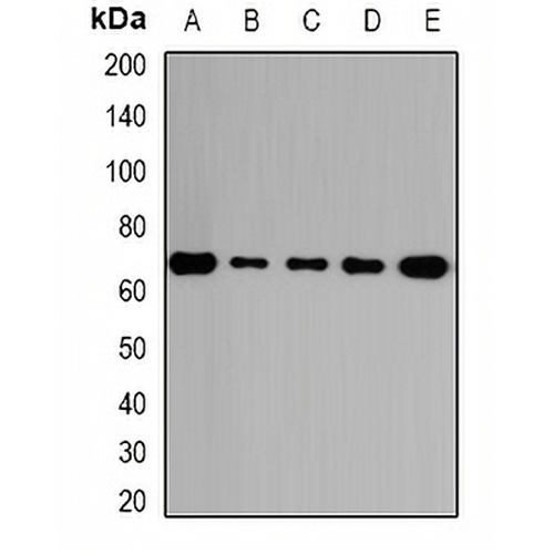 GalNAc-T2 Rabbit Polyclonal Antibody