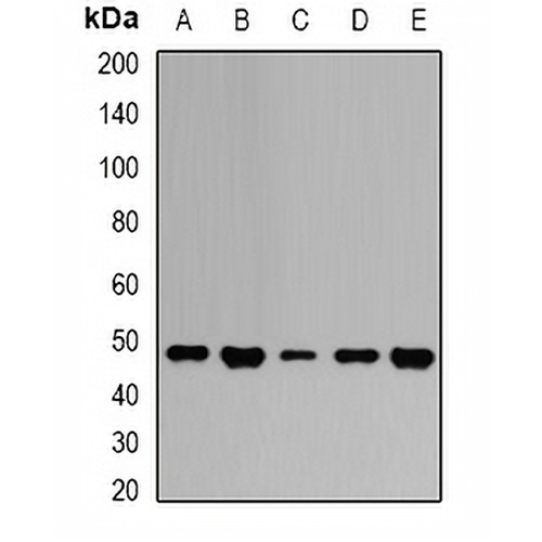 GOT2 Rabbit Polyclonal Antibody