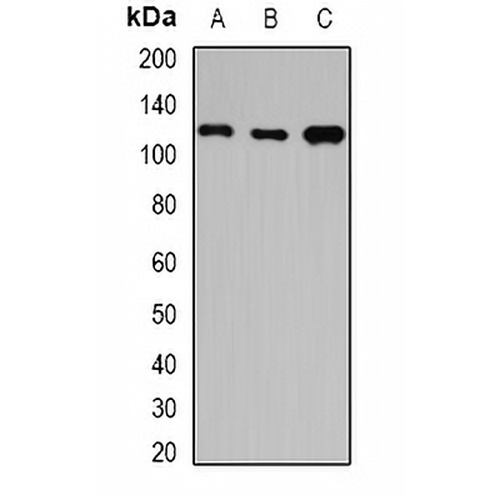 HIP1 Rabbit Polyclonal Antibody