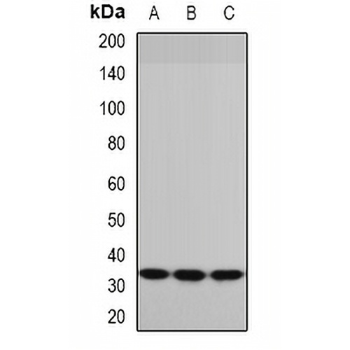 P5CR Rabbit Polyclonal Antibody