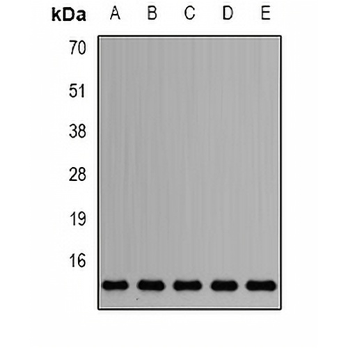 Sm-D2 Rabbit Polyclonal Antibody