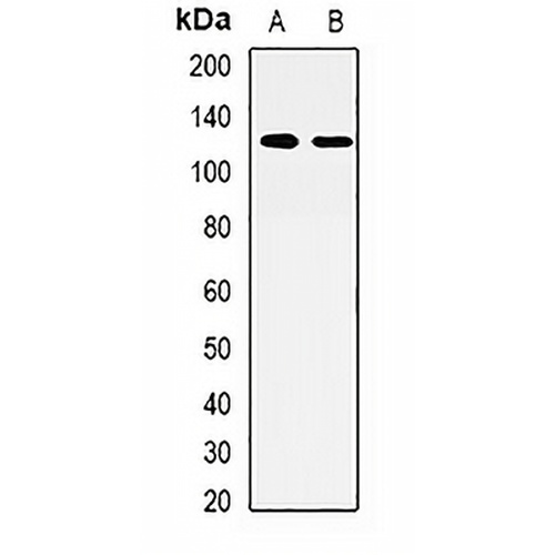 AP3-beta-1 Rabbit Polyclonal Antibody