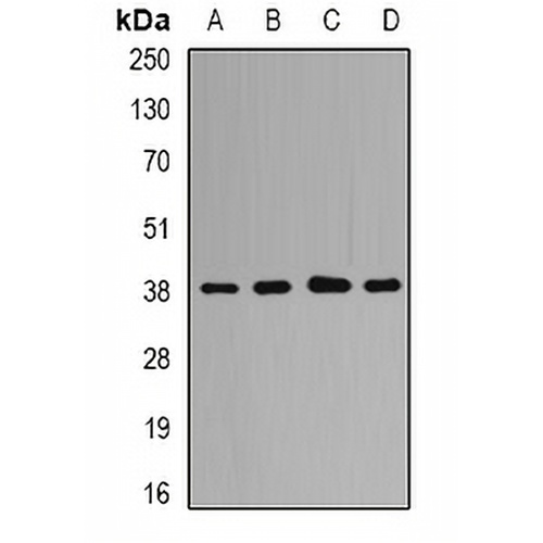 QKI Rabbit Polyclonal Antibody
