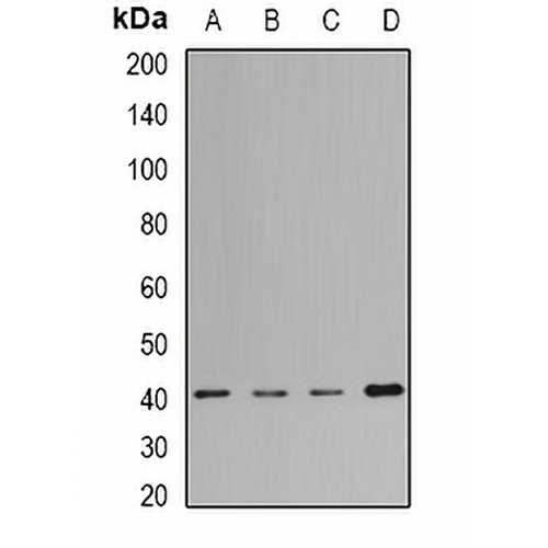 MacroH2A1 Rabbit Polyclonal Antibody