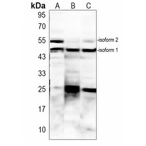 ERp5 Rabbit Polyclonal Antibody