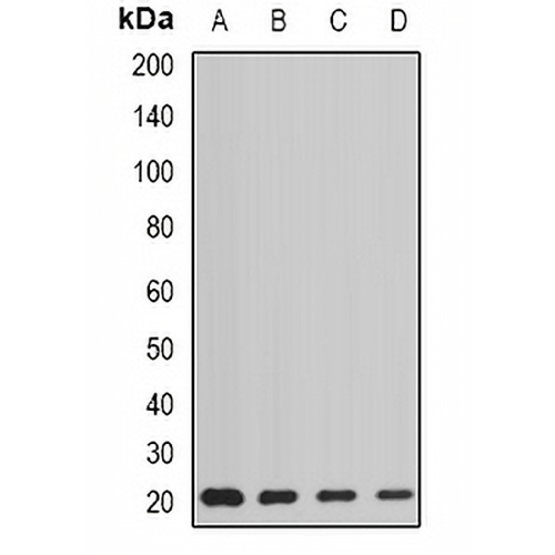 AGR2 Rabbit Polyclonal Antibody