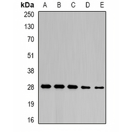 NFU1 Rabbit Polyclonal Antibody