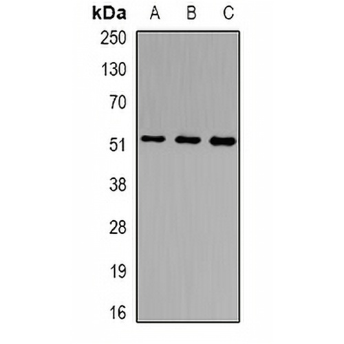 NSUN6 Rabbit Polyclonal Antibody
