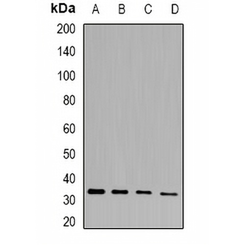 PHYHD1 Rabbit Polyclonal Antibody
