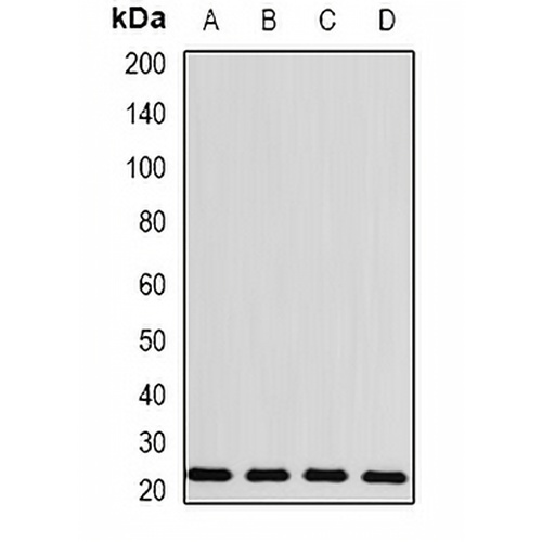 BLVRB Rabbit Polyclonal Antibody