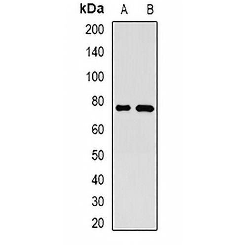 GP73 Rabbit Polyclonal Antibody