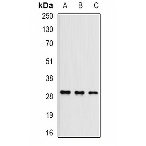 UBE2J2 Rabbit Polyclonal Antibody