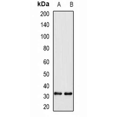 WBSCR22 Rabbit Polyclonal Antibody