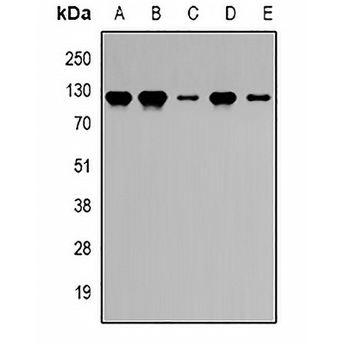 PRDM5 Rabbit Polyclonal Antibody