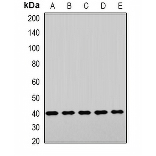 LHX6 Rabbit Polyclonal Antibody