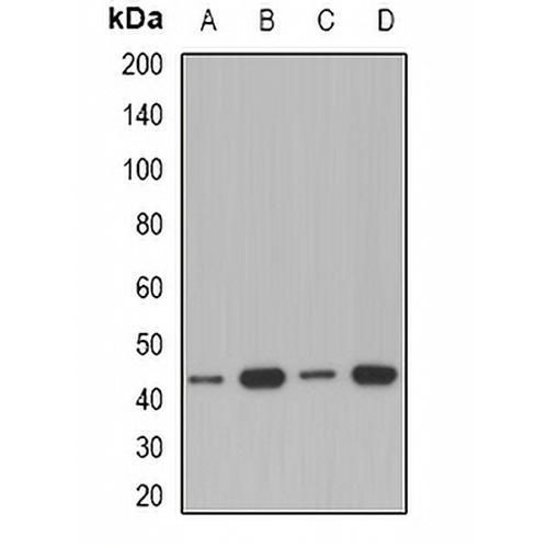 ACAA1 Rabbit Polyclonal Antibody