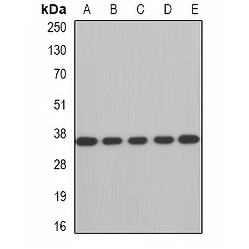 AUH Rabbit Polyclonal Antibody