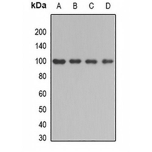 BBS2 Rabbit Polyclonal Antibody