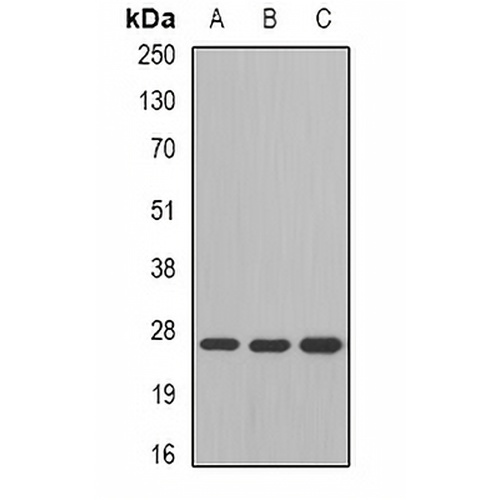 GSTM4 Rabbit Polyclonal Antibody