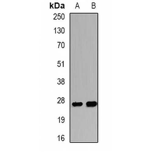 WISP2 Rabbit Polyclonal Antibody