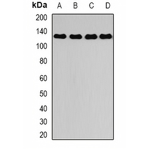 DAAM2 Rabbit Polyclonal Antibody