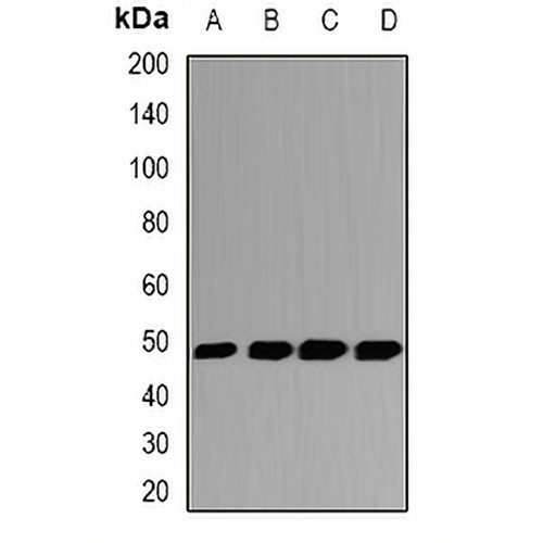 GSDML Rabbit Polyclonal Antibody