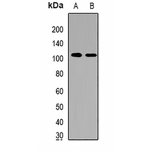 HRP2 Rabbit Polyclonal Antibody