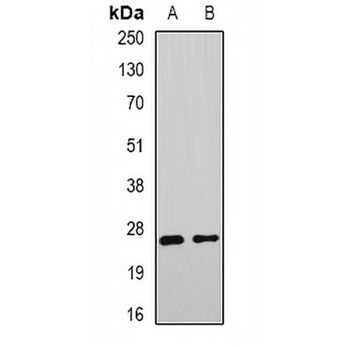 DNAJB9 Rabbit Polyclonal Antibody