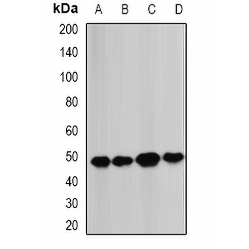 BCS1L Rabbit Polyclonal Antibody