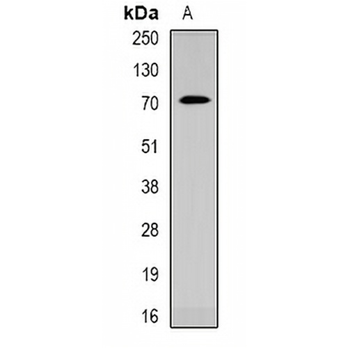 CACNB1 Rabbit Polyclonal Antibody