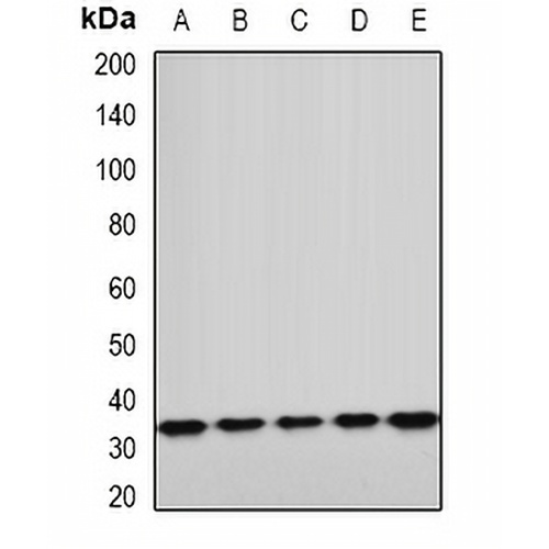 ETFA Rabbit Polyclonal Antibody