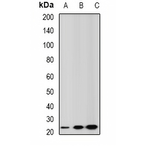 GSTA2 Rabbit Polyclonal Antibody