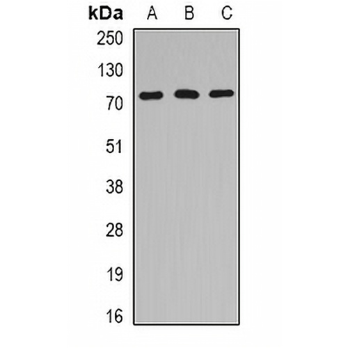 HSPA6 Rabbit Polyclonal Antibody